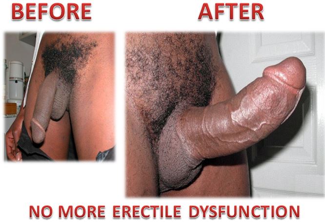erectile-1-1-1-1-1-1